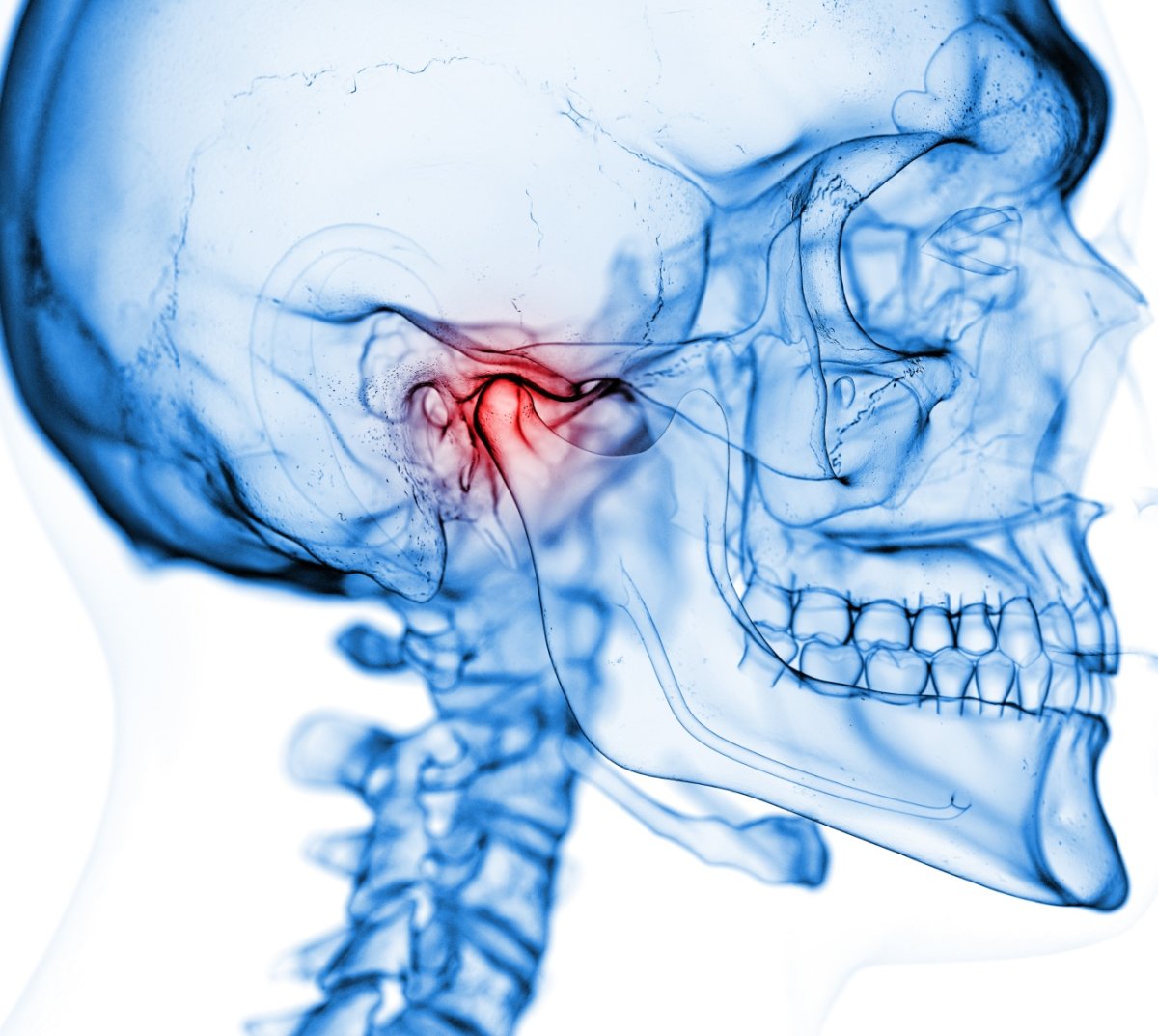 Qu’est-ce que l’articulation temporo-mandibulaire ??